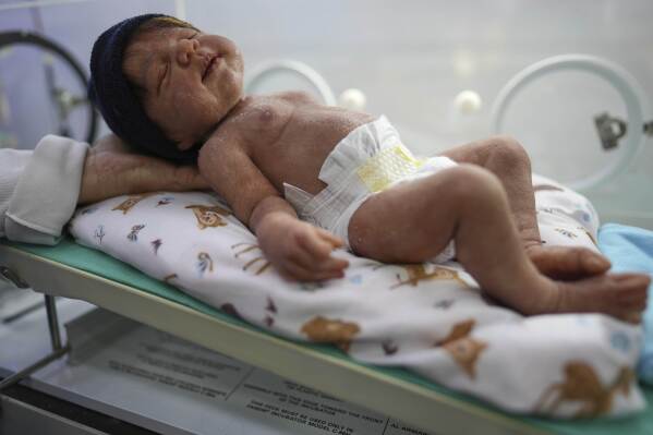 A hyper-realistic reborn baby doll lies in an incubator for sale at a store in Campinas, Brazil Saturday, May 24, 2025. (AP Photo/Andre Penner)