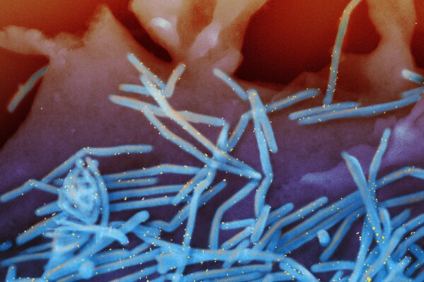This electron microscope image provided by the National Institutes of Health shows human respiratory syncytial virus (RSV) virions, colorized blue, and anti-RSV F protein/gold antibodies, colorized yellow, shedding from the surface of human lung cells. (National Institute of Allergy and Infectious Diseases, NIH via AP, File)