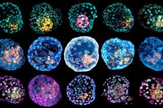 This undated combination of microscope images provided by Monash University in March 2021 shows different "iBlastoids" (embryo-like structures) stained to highlight different cell types. Scientists made the cell structures in a lab and say they will allow for more research into the earliest stages of human development without running afoul of restrictions on using real embryos. (Monash University via AP)