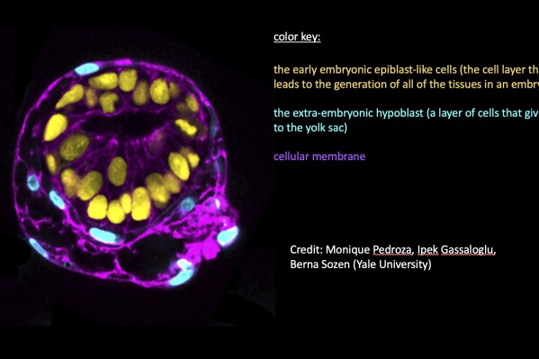 This graphic provided by Yale University shows an image of a human embryo model. (Monique Pedroza, Ipek Gassaloglu, Berna Sozen/Yale University via AP)