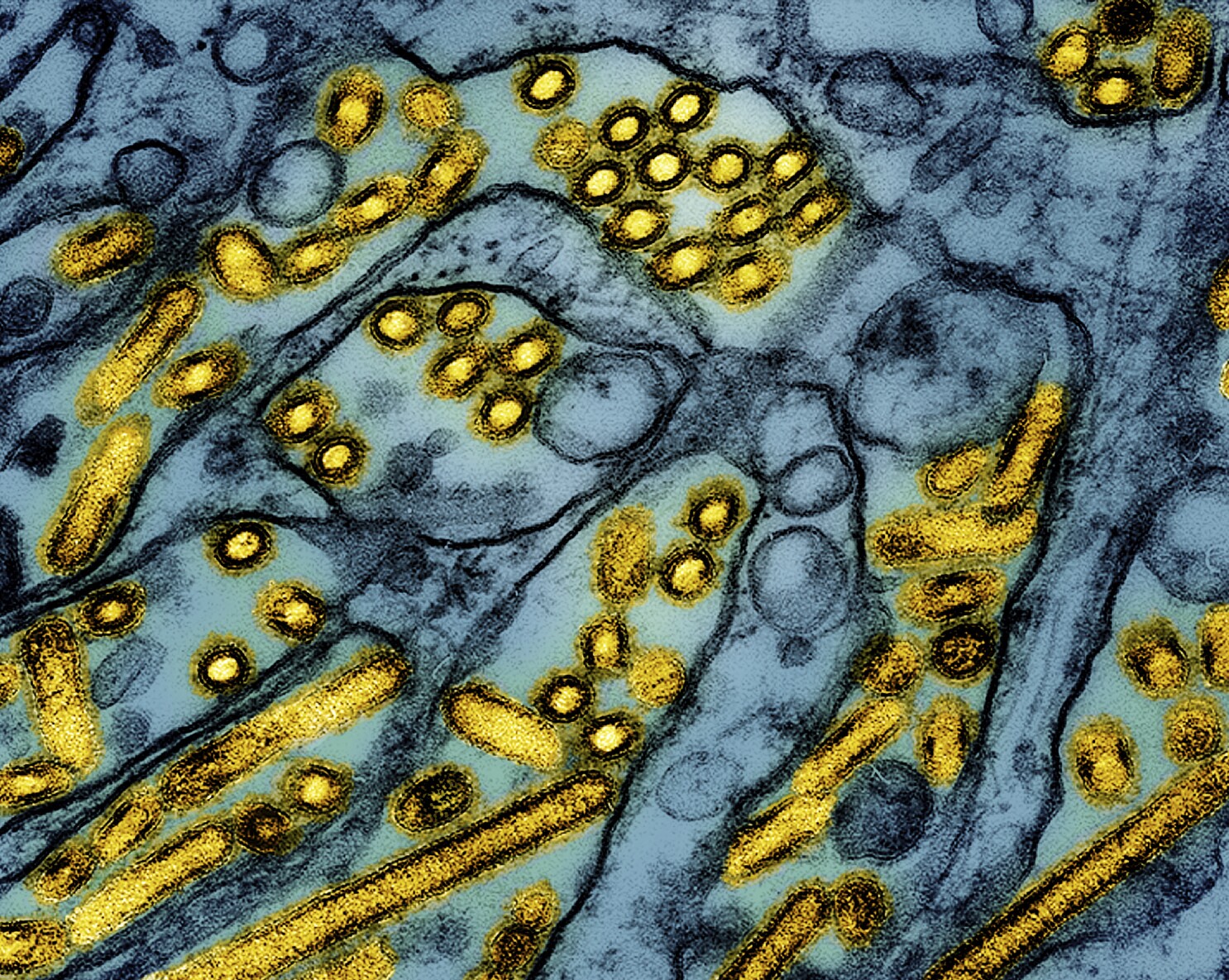 Bird flu hits a poultry producer in Georgia, first time since 2022