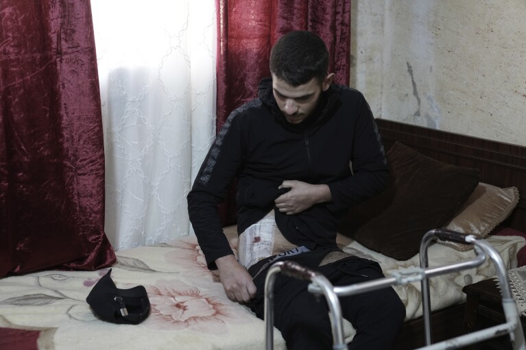 Mohammed Rimawi recovers from his injuries on Sunday, Jan. 7, 2024, after he was wounded by Israeli forces in a shooting last week in the occupied West Bank village of Beit Rima that also injured his brother and killed a 17-year-old.  (AP Photo/Mahmoud Illean)