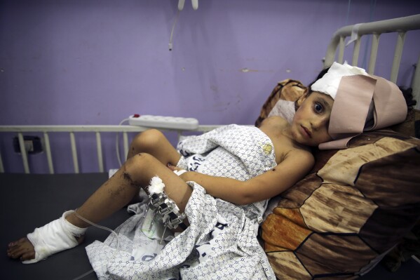Kenzi al Madhoun, a four-year-old who was wounded in an Israeli bombardment, lies at Al Aqsa Hospital in Deir al Balah City, Gaza Strip, Wednesday, Nov. 1, 2023. (AP Photo/Abdel Kareem Hana)