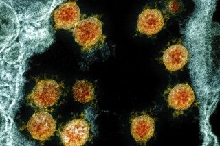 This electron microscope image made available and color-enhanced by the National Institute of Allergy and Infectious Diseases Integrated Research Facility in Fort Detrick, Md., shows Novel Coronavirus SARS-CoV-2 virus particles, orange, isolated from a patient. University of Hong Kong scientists claim to have the first evidence of someone being reinfected with the virus that causes COVID-19. They said Monday, Aug. 24, 2020 that genetic tests show a 33-year-old man returning to Hong Kong from a trip to Spain in mid-August had a different strain of the coronavirus than the one he’d previously been infected with in March. (NIAID/National Institutes of Health via AP)