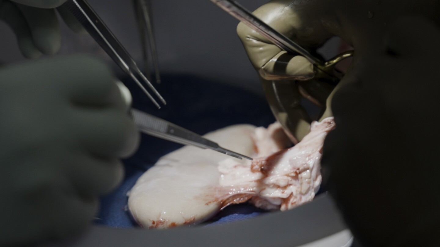 A Pig Kidney Was Just Transplanted Into a Human Body, and It Is Still  Working - Scientific American