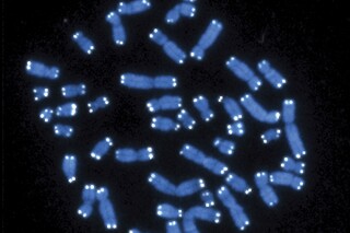 FILE - This microscope image shows the 46 human chromosomes, blue, with telomeres appearing as white pinpoints. Scientists have found the genetic cause of a neurodevelopmental disorder that they estimate affects as many as one in 20,000 young people. And they hope their discovery leads to a new diagnosis that can provide answers to families. They published their findings in the journal Nature Medicine on Friday (Hesed Padilla-Nash, Thomas Ried/National Cancer Institute/National Institutes of Health via AP, File)