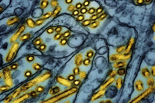 FILE -This colorized electron microscope image released by the National Institute of Allergy and Infectious Diseases on March 26, 2024, shows avian influenza A H5N1 virus particles (yellow), grown in Madin-Darby Canine Kidney (MDCK) epithelial cells (blue). (CDC/NIAID via AP, File)