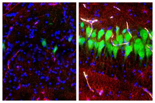 This combination of images provided by the Yale School of Medicine in April 2019 shows stained microscope photos of neurons, green; astrocytes, red, and cell nuclei, blue, from a pig brain left untreated for 10 hours after death, left, and another with a specially designed blood substitute pumped through it. By medical standards “this is not a living brain,” said Nenad Sestan of the Yale School of Medicine, one of the researchers reporting the results Wednesday, April 17, 2019, in the journal Nature. But the work revealed a surprising degree of resilience within a brain that has lost its supply of blood and oxygen, he said. (Stefano G. Daniele, Zvonimir Vrselja/Sestan Laboratory/Yale School of Medicine)