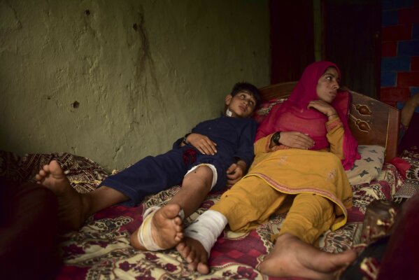 FILE - In this Aug. 9, 2019, file photo, Pakistani Kashmiri boy Fakhar, 11, who was allegedly injured with his sister Sadaf Bibi, 18, by an artillery fired across the border, rests at his home in Chilana, situated at the Line of Control between Pakistan and India. The Line of Control, a highly militarized de facto border that divides the disputed region between the two nuclear-armed rivals India and Pakistan, and a site of hundreds of deaths, is unusually quiet after the two South Asian neighbors agreed in February, 2021, to reaffirm their 2003 cease-fire accord. (AP Photo/M.D. Mughal, File)