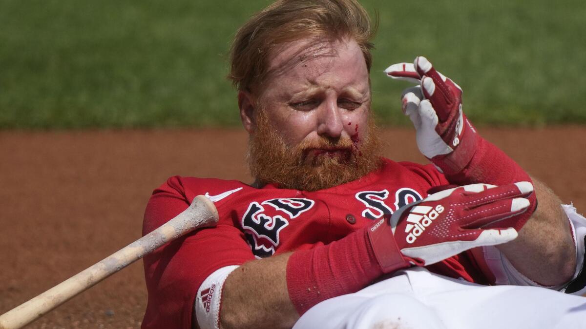 🤕 Former Dodgers player Justin Turner HIT IN THE FACE by a pitch