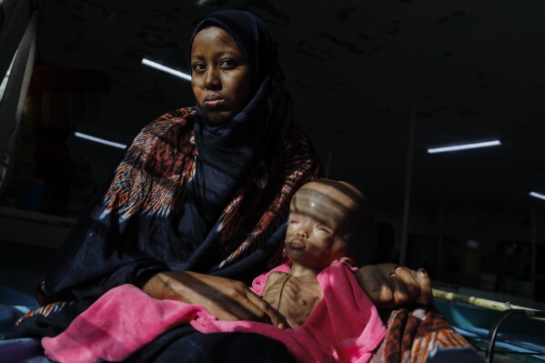 Dool Abdirahman, 25, who fled Somalia with her malnourished baby daughter Hakimo Mohamed Abdullahi, 11 months old, when the infant developed hydrocephalus, or a buildup of fluid on the brain, at the International Rescue Committee (IRC) hospital in Dadaab refugee camp in northern Kenya, Wednesday, July 12, 2023. One of the world's largest refugee camps offers a stark example of the global food security crisis with thousands of people fleeing Somalia in recent months to escape drought and extremism but finding little to eat when they arrive at the Dadaab camp in neighboring Kenya. (AP Photo/Brian Inganga)