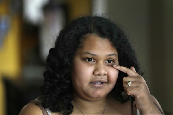 Sima Gutierrez points to discoloration of her skin due to the water crisis during an interview, Monday, March 25, 2024, in Flint, Mich. Dozens of children of the water crisis, including Gutierrez, have turned their trauma into advocacy. (AP Photo/Carlos Osorio)