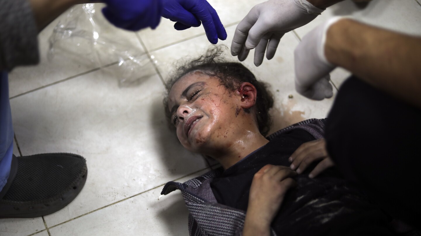 Guerre Israël-Hamas : 60 000 Palestiniens blessés accablent les médecins de Gaza
