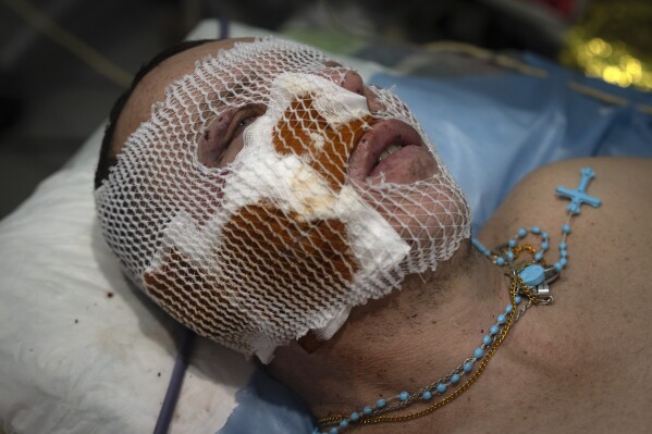 A wounded Ukrainian soldier lays on the operating table at a medical stabilisation point near Bakhmut, Donetsk region, Ukraine, Friday, Jan. 26, 2024. (AP Photo/Efrem Lukatsky)
