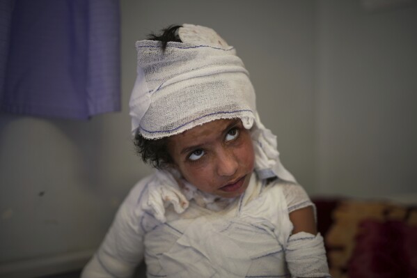 Hamza Abu Shabab, 7, sits in bed with third-degree burns caused when, frightened by an Israeli airstrike, he spilled a hot plate of rice and lentils on himself in the family's tent in southern Gaza last month, at Nasser hospital in Khan Younis, Gaza Strip, Sunday, May 4, 2025.(AP Photo/Abdel Kareem Hana)