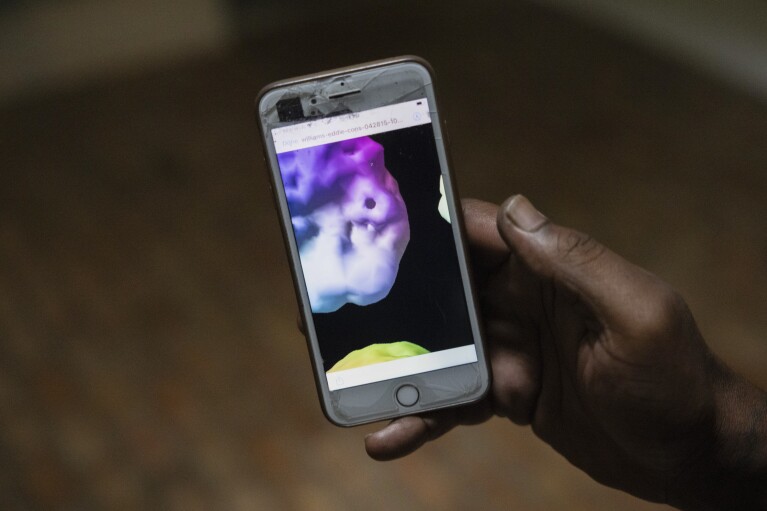 Former NFL player Boo Williams shows scans of his brain injuries on his phone in Picayune, Miss., Wednesday, Nov. 15, 2023. (AP Photo/Christiana Botic)