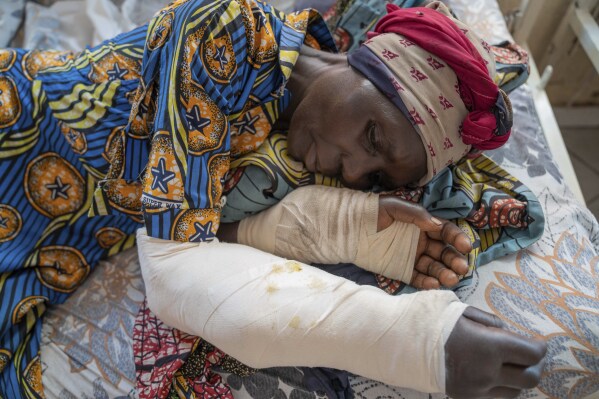 A woman who was wounded in ongoing fighting between M-23 rebel forces and Congolese forces in the Sake region West of Goma, eastern Congo, lies on her hospital bed in Goma, Tuesday, Feb. 13, 2024. In recent days, main roads around Goma and Sake, routes that are crucial for the movement of civilians, goods, and humanitarian aid, have become impassable due to intensified fighting, further restricting access to essential services and supplies said humanitarian aid organisation, Mercy Corps. (AP Photo/Moses Sawasawa)