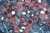 FILE - This undated image provided by the National Institute of Allergy and Infectious Diseases shows a colorized transmission electron micrograph of monkeypox particles (red) found within an infected cell (blue), cultured in the laboratory that was captured and color-enhanced at the NIAID Integrated Research Facility in Fort Detrick, Md. (NIAID via AP, File)