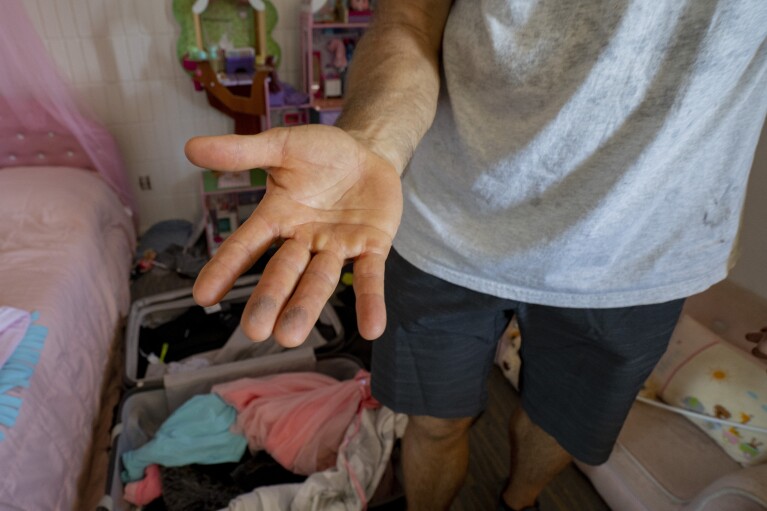 Daniel Skousen shows his fingers covered with ashes after lightly touching his daughter's toys on Friday, Nov. 3, 2023, in Lahaina, Hawaii. Most of Skousen's home is covered with a coat of ashes from August's wildfire. (AP Photo/Mengshin Lin)