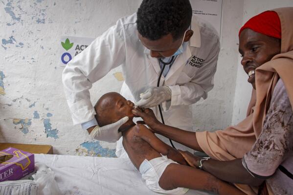 Doctor Mustaf Yusuf treats Ali Osman, 3, who is showing symptoms of Kwashiorkor, a severe protein malnutrition causing swelling and skin lesions, as his mother Owliyo Hassan Salaad, 40, holds him at a malnutrition stabilization center run by Action against Hunger, in Mogadishu, Somalia Sunday, June 5, 2022. Deaths have begun in the region's most parched drought in decades and previously unreported data show nearly 450 deaths this year at malnutrition treatment centers in Somalia alone. (AP Photo/Farah Abdi Warsameh)