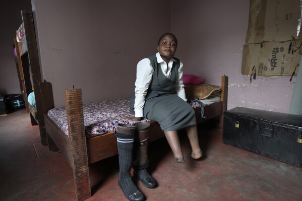 Bridget Chanda está sentada em sua cama ao lado de suas pernas protéticas dentro de seu dormitório na Escola Especial Chileshe Chepela em Kasama, Zâmbia, quinta-feira, 7 de março de 2024. A parte inferior de suas pernas foi amputada depois que ela desenvolveu gangrena. (Foto AP/Tsvangirayi Mukwazhi)