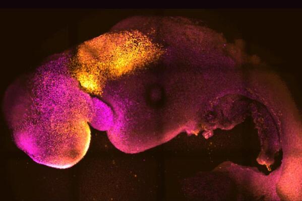 This microscope image provided by researchers Gianluca Amadei and Charlotte Handford in August 2022 shows a synthetic mouse embryo with colors added to show brain and heart formation. According to a study published in the journal Nature on Thursday, Aug. 25, scientists have created “synthetic” mouse embryos from stem cells without a dad's sperm or a mom's egg or womb. (Gianluca Amadei, Charlotte Handford via AP)