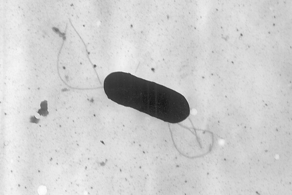This 2002 electron microscope image made available by the Centers for Disease Control and Prevention shows a Listeria monocytogenes bacterium. (Elizabeth White/CDC via AP, File)