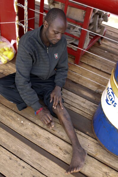 Mouctar Diallo, from Guinea, shows scars on his leg he claims were from violence suffered in Libya as he sits aboard the Ocean Viking humanitarian rescue ship, in the Mediterranean Sea, Friday, Sept. 13, 2019. Diallo was rescued at sea on Sept. 8, his birthday, by the Ocean Viking in his fifth attempt to reach Europe from Libya. (AP Photo/Renata Brito)