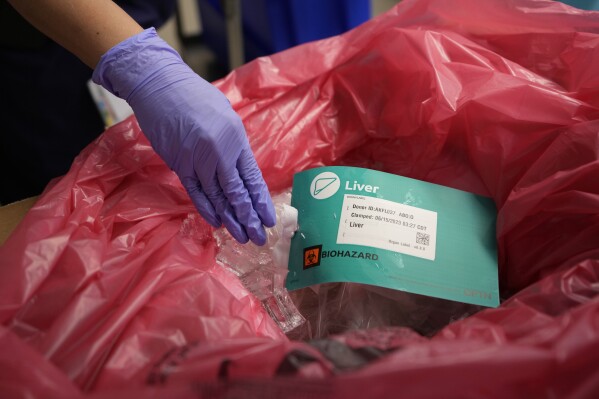 A liver is prepared for transport after it has been removed from an organ donor June 15, 2023, in Jackson, Tenn. Cancer was later found in the donor’s lungs so the liver couldn’t be used for transplant. (AP Photo/Mark Humphrey)