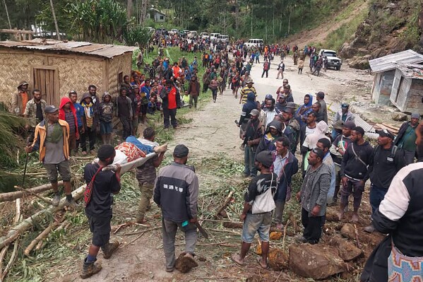 In this photo provided by the International Organization for Migration, an injured person is carried on a stretcher to seek medical assistance after a landslide in Yambali village, Papua New Guinea, Friday, May 24, 2024. More than 100 people are believed to have been killed in the landslide that buried a village and an emergency response is underway, officials in the South Pacific island nation said. The landslide struck Enga province, about 600 kilometers (370 miles) northwest of the capital, Port Moresby, at roughly 3 a.m., Australian Broadcasting Corp. reported. (Benjamin Sipa/International Organization for Migration via AP)