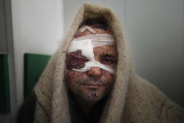 Serhiy Kralya, 41, looks at the camera after surgery at a hospital in Mariupol, eastern Ukraine on Friday, March 11, 2022. Kralya was injured during shelling by Russian forces. (AP Photo/Evgeniy Maloletka)