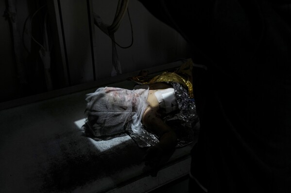 Palestinian child Siwar Abdel-Hadi, 2, wounded in the Israeli bombardment of the Gaza Strip, lies for an X-ray at a hospital in Deir al-Balah, Wednesday, July 24, 2024. (AP Photo/Abdel Kareem Hana)