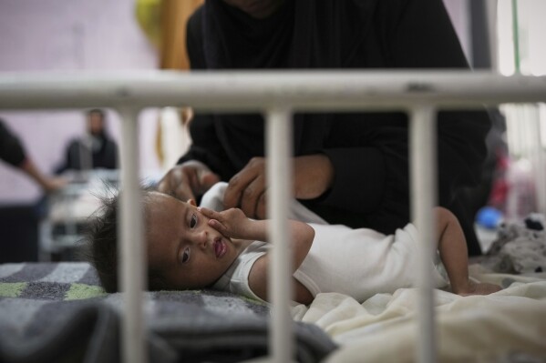 AP PHOTOS: Many in Gaza face malnutrition and starvation as blockade enters its 3rd month
