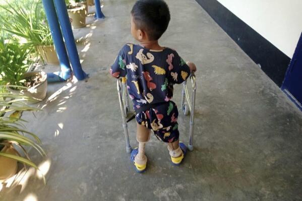 In this photo provided by the family, a young landmine victim learns to use his new prosthetic limbs at Hpa-An Orthopedic Rehabilitation Center in Hpa-An township, Karen State, Myanmar, on Dec. 7, 2022. The boy lost his legs in a landmine blast in July 2022. He speaks frequently about the blast, but his mother isn't sure he'll ever process what happened. “Maybe he still doesn’t understand,” she said. “He is still young.” (Family photo via AP)