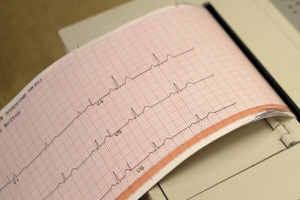FILE - This May 26, 2009 file photo shows a printout from an electrocardiogram machine in Missouri. Doctors are reporting that novel drugs may offer fresh ways to reduce heart risks beyond the usua...