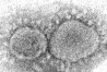 FILE - This 2020 electron microscope image made available by the Centers for Disease Control and Prevention shows SARS-CoV-2 virus particles which cause COVID-19. If you’ve been sick with COVID-19, you may have some protection against certain versions of the common cold. A study published Wednesday, June 12, 2024, in the journal Science Translational Medicine, suggests previous COVID-19 infections lower the risk of getting colds caused by milder coronavirus cousins, which could provide a key to broader COVID-19 vaccines. (Hannah A. Bullock, Azaibi Tamin/CDC via AP, File)
