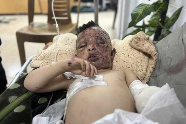 This undated photo provided by Maha Abu Kawaik shows Omar Abu Kuwaik at a hospital in Gaza shortly after being pulled from the ruins of his home that was bombed during an Israeli airstrike. Through the efforts of a chain of family and strangers, Omar was brought out of Gaza and flown to the United States, where he received treatment including a prosthetic arm. (Maha Abu Kuwaik via AP)