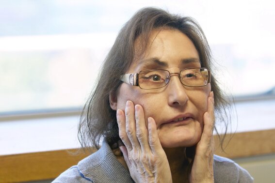 FILE - In this Sept. 14, 2010, file photo, Connie Culp, the nation’s first partial face transplant recipient, speaks with the Associated Press at the Cleveland Clinic in Cleveland.  Culp, the recipient of the first partial face transplant in the U.S., has died at 57, almost a dozen years after the groundbreaking operation. The Cleveland Clinic, where her surgery had been performed in 2008, said Saturday that Culp died Wednesday, July 29, 2020 at the Ohio clinic of complications from an infection unrelated to her transplant.  (AP Photo/Jason Miller, File)