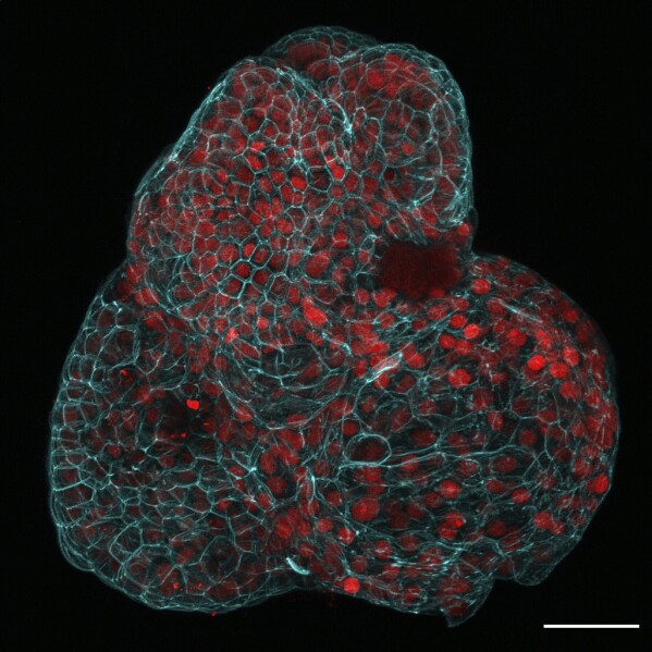 This microscope image provided by researchers in March 2024 shows a lung organoid created from cells collected from amniotic fluid. In a study published Monday, March 4, 2024, in the journal Nature Medicine, scientists in the United Kingdom described how they have made mini-organs from cells floating in amniotic fluid – an advance they believe could open up new areas of prenatal medicine. (Giuseppe Calà, Paolo De Coppi, Mattia Gerli via AP)