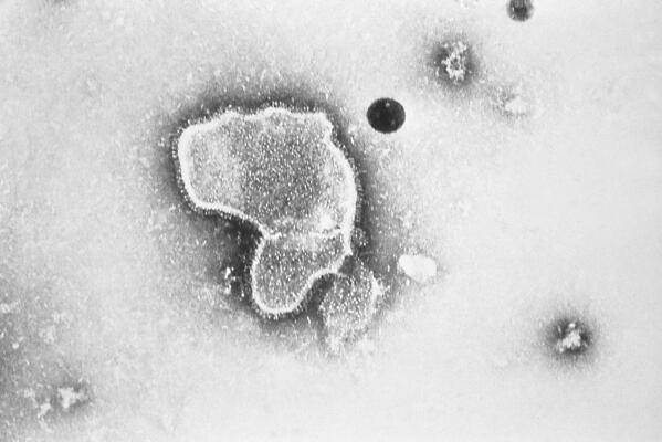 FILE - This 1981 photo provided by the Centers for Disease Control and Prevention (CDC) shows an electron micrograph of Respiratory Syncytial Virus, also known as RSV.  New research announced by Pfizer on Tuesday, Nov. 1, 2022, showed vaccinating pregnant women helped protect their newborns from the common but scary respiratory virus that fills hospitals with wheezing babies each fall.  (CDC via AP, File)