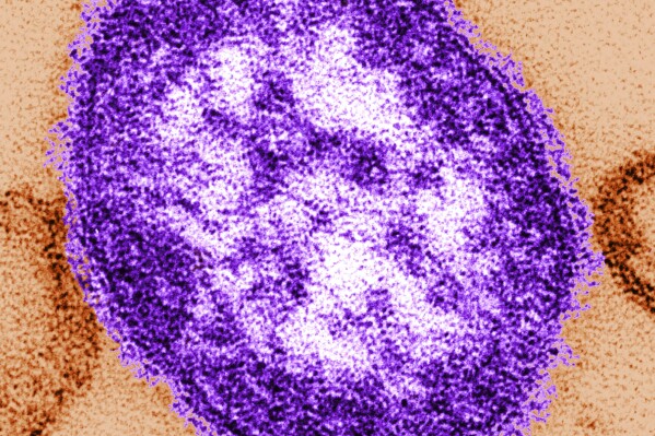 FILE - This undated image made available by the Centers for Disease Control and Prevention on Feb. 4, 2015, shows an electron microscope image of a measles virus particle, center. A West Virginia hospital has identified the first case of measles in the state since 2009, health officials said Monday, April 22, 2024. (Cynthia Goldsmith/Centers for Disease Control and Prevention via AP, File)