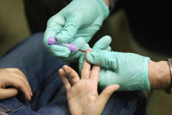 Us Lowers Cutoff For Lead Poisoning In Young Kids | Ap News