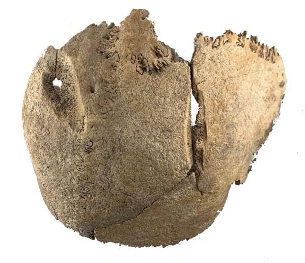 Un cranio con un trauma acuto trovato durante uno scavo di una fossa comune romana della fine del I secolo d.C. nel quartiere Simmering di Vienna, Austria, fotografato giovedì 27 marzo 2025. (S. Strang/Novetus tramite AP)
