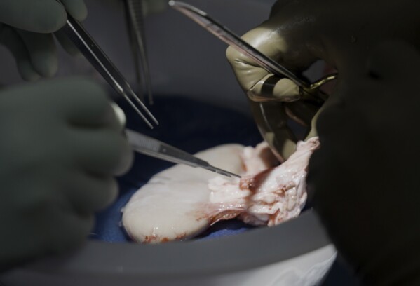Surgeons at NYU Langone Health prepare to transplant a pig's kidney into a brain-dead man in New York on July 14, 2023. Researchers around the country are racing to learn how to use animal organs to save human lives. (AP Photo/Shelby Lum)