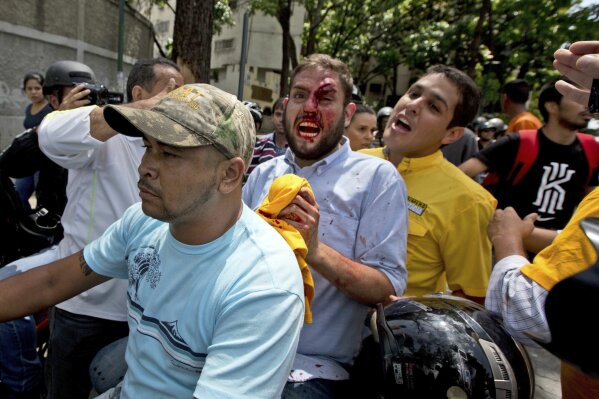 Opposition lawmaker Juan Requesens, center, is escorted by his colleague Jose Manuel Olivares, right, after begin injured by alleged pro government supporters as they protest outside of the Ombudsman's offices in Caracas, Venezuela, Monday, April 3, 2017. A group of opposition lawmakers was attacked by suspected followers of the Government during a demonstration in the center of the capital that left at least one injured Congressman. (AP Photo/Fernando Llano)