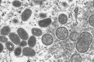 FILE - This 2003 electron microscope image made available by the Centers for Disease Control and Prevention shows mature, oval-shaped monkeypox virions, left, and spherical immature virions, right, obtained from a sample of human skin associated with the 2003 prairie dog outbreak. British health officials reported 73 more monkeypox cases on Monday, June 6, 2022, raising the total to more than 300 across the country. (Cynthia S. Goldsmith, Russell Regner/CDC via AP, File)