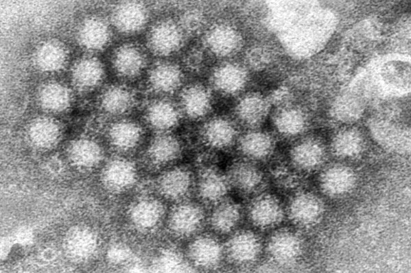 This electron microscope image provided by the Centers for Disease Control and Prevention shows a cluster of norovirus virions. On Thursday, Feb. 29, 2024, the Centers for Disease Control and Prevention said that cases of norovirus, a nasty stomach bug that spreads easily, are climbing in the Northeastern U.S. (Charles D. Humphrey/CDC via AP)