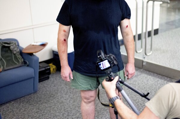 A federal officer displays wounds for a law enforcement photographer to document after a skirmish with protesters at the Mark O. Hatfield U.S. Courthouse early Saturday, July 25, 2020, in Portland, Ore. On the streets of Portland, a strange armed conflict unfolds night after night. It is raw, frightening and painful on both sides of an iron fence separating the protesters on the outside and federal agents guarding a courthouse inside. This weekend, journalists for The Associated Press spent the weekend both outside, with the protesters, and inside the courthouse, with the federal agents, documenting the fight that has become an unlikely centerpiece of the protest movement gripping America. (AP Photo/Noah Berger)