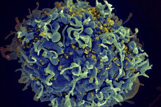 
              This electron microscope image made available by the U.S. National Institutes of Health shows a human T cell, in blue, under attack by HIV, in yellow, the virus that causes AIDS. The virus specifically targets T cells, which play a critical role in the body's immune response against invaders like bacteria and viruses. Colors were added by the source. On Thursday, March 7, 2019, researchers reported that monthly shots of HIV drugs worked as well as daily pills to control the virus that causes AIDS in two large international tests. (Seth Pincus, Elizabeth Fischer, Austin Athman/National Institute of Allergy and Infectious Diseases/NIH via AP)
            