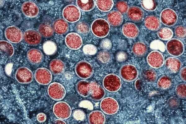 FILE - This image provided by the National Institute of Allergy and Infectious Diseases (NIAID) shows a colorized transmission electron micrograph of monkeypox particles (red) found within an infected cell (blue), cultured in the laboratory that was captured and color-enhanced at the NIAID Integrated Research Facility (IRF) in Fort Detrick, Md.  The official IRNA news agency reported announced Tuesday, Aug. 16, 2022, the first case of monkeypox in the nation. The report said health authorities quarantined a 34-year-old woman living in the southwestern city of Ahvaz. (NIAID via AP, File)